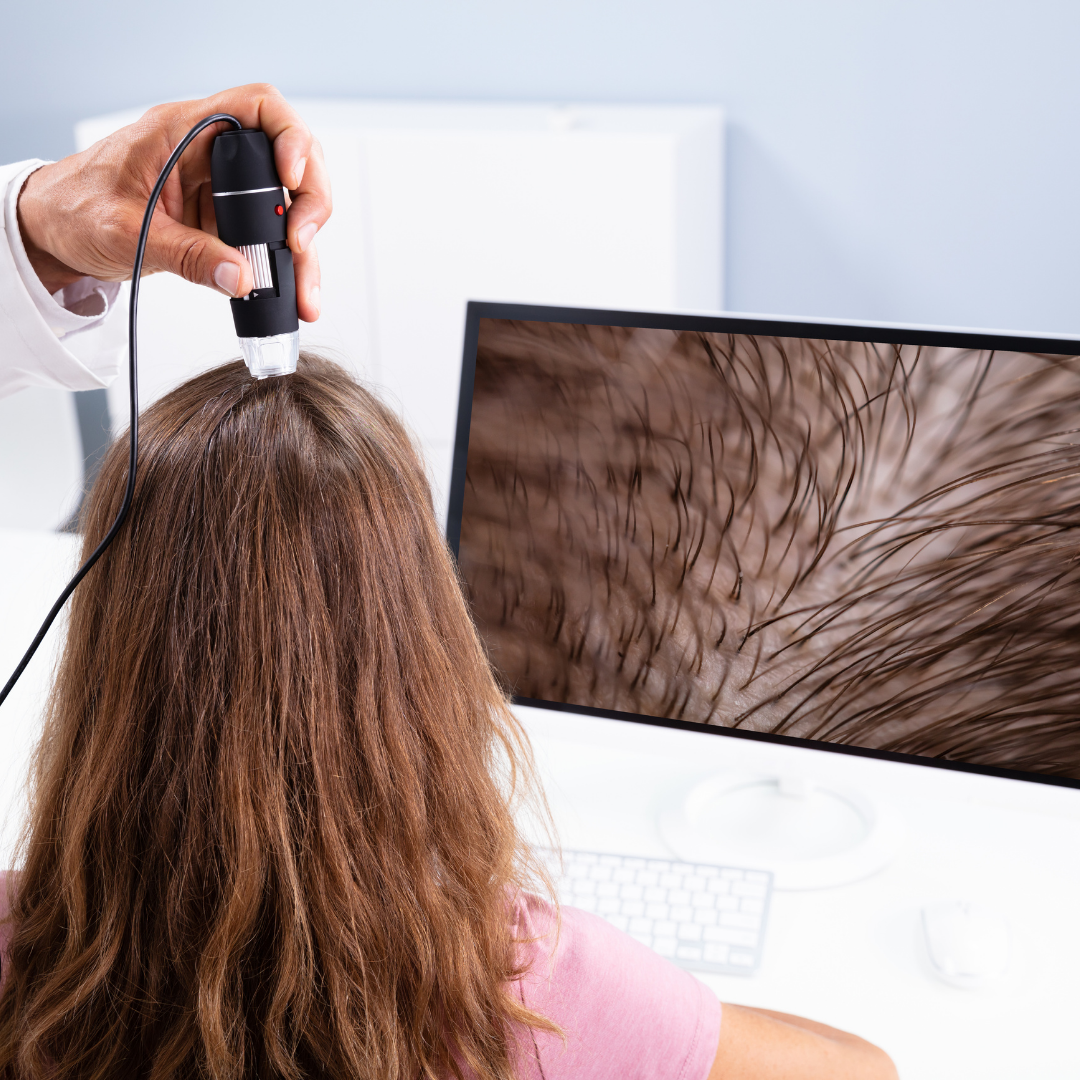 PRP Hair Treatment Process